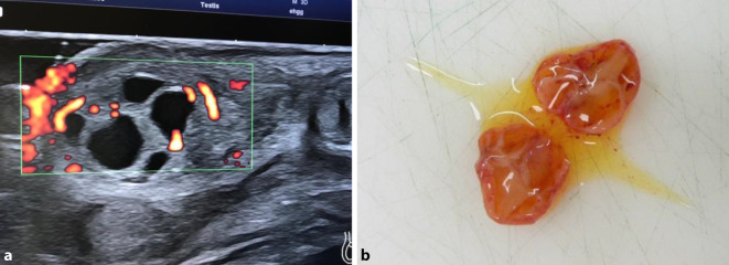 graphic file with name 120_2020_1391_Fig2_HTML.jpg