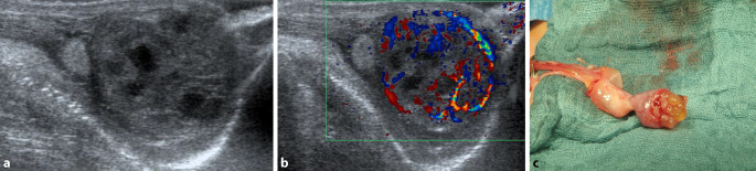 graphic file with name 120_2020_1391_Fig1_HTML.jpg