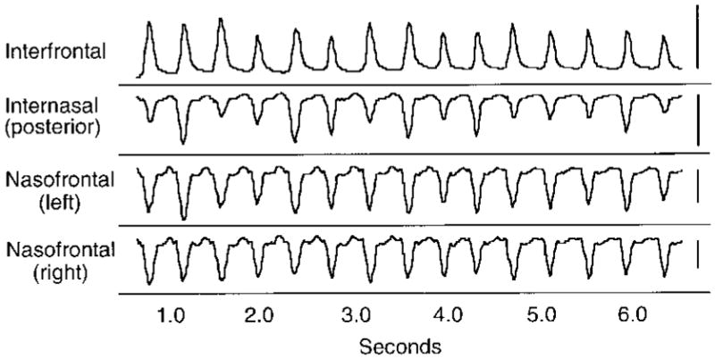 Fig. 3