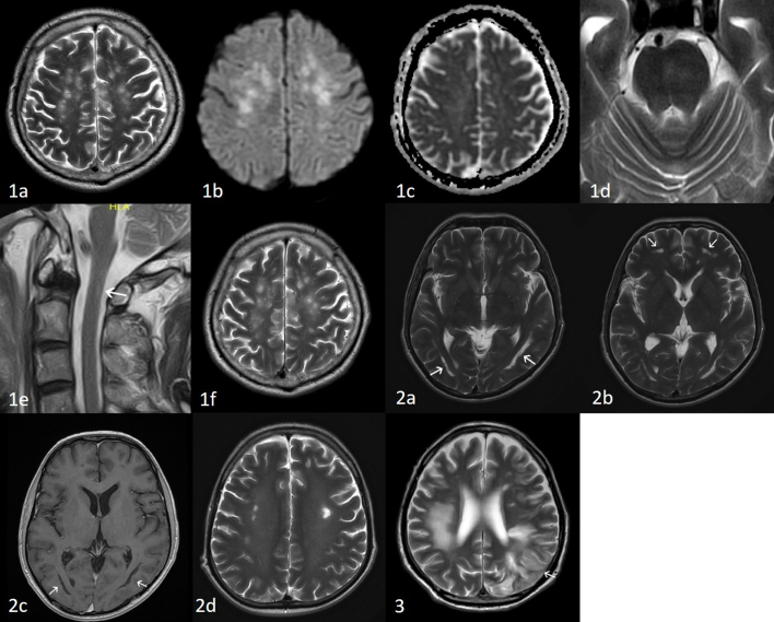 Figs. 1–3