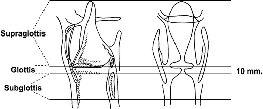 Fig. 1