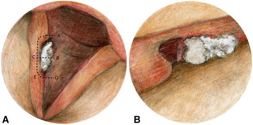 Fig. 9