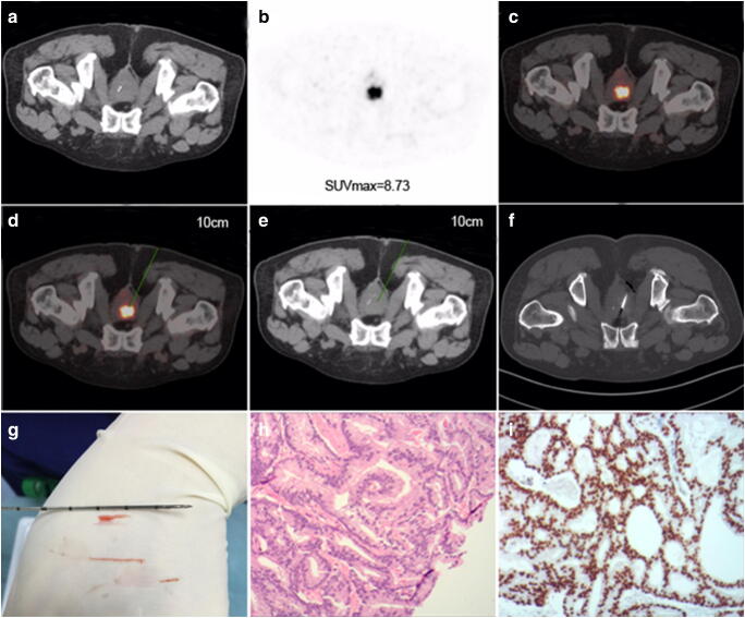 Fig. 4