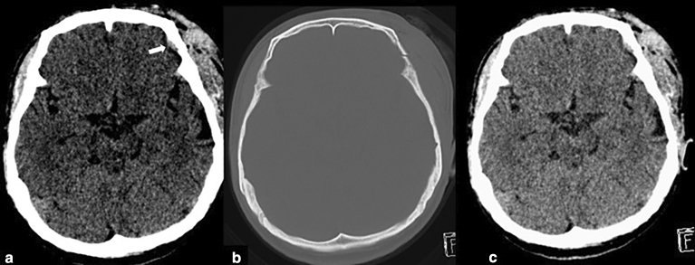 Figure 6