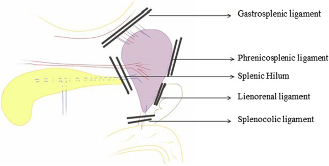 Splenectomy and Distal Pancreaticosplenectomy: Surgical Anatomy and ...