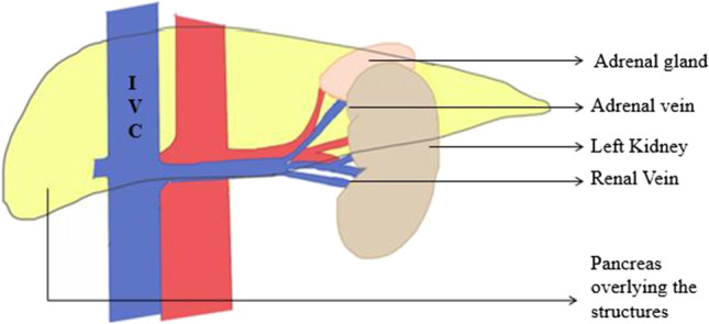 Splenectomy and Distal Pancreaticosplenectomy: Surgical Anatomy and ...