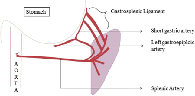 Splenectomy and Distal Pancreaticosplenectomy: Surgical Anatomy and ...