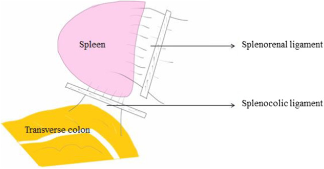 Splenectomy and Distal Pancreaticosplenectomy: Surgical Anatomy and ...