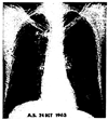 FIG. 28