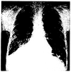 FIG. 23