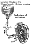 FIG. 21