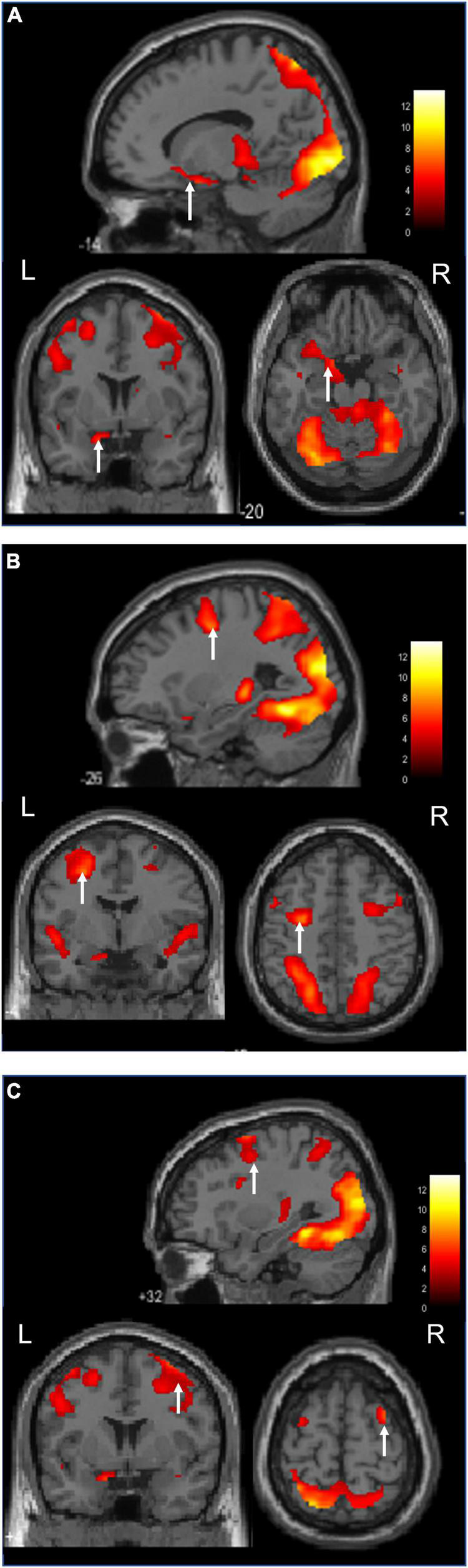 FIGURE 3