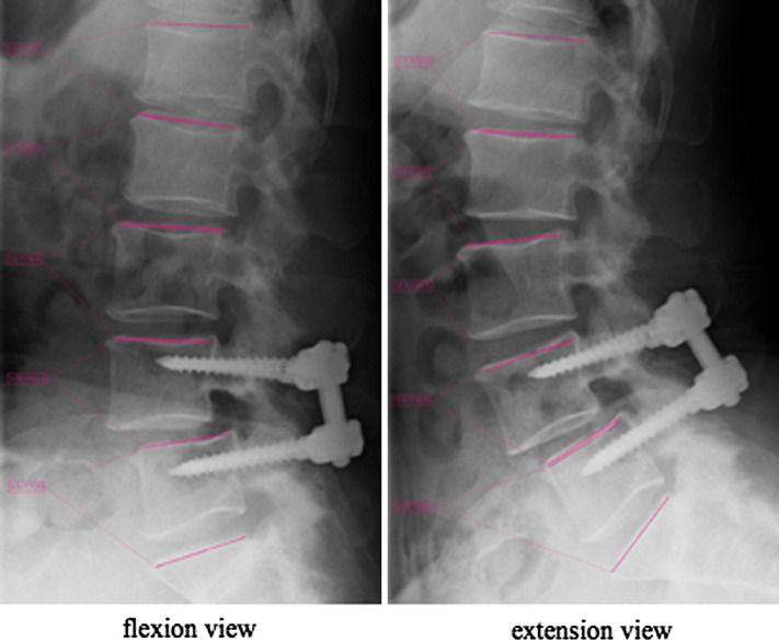 Fig. 1