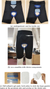 Fig. 14