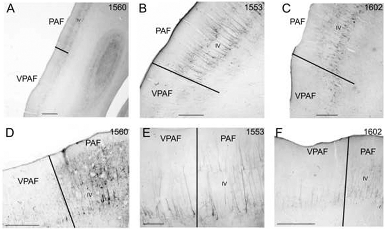 Figure 11.