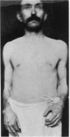 216-1