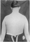 216-2
