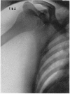216-2