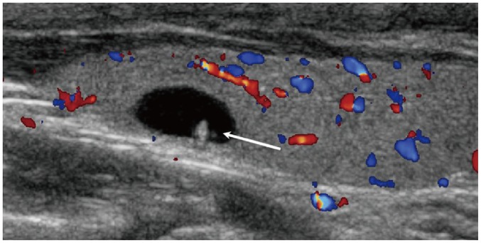 Fig. 9