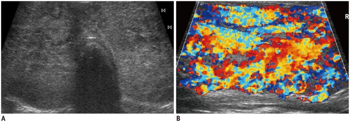 Fig. 13