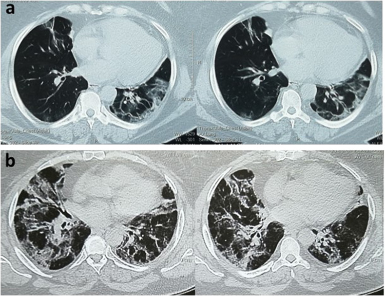 Fig. 1