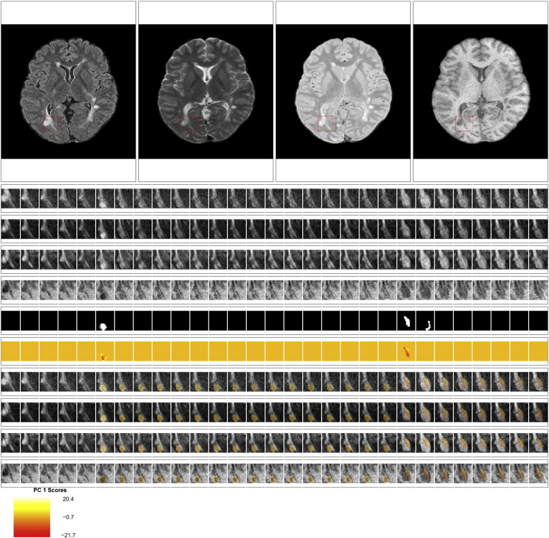 Fig. 10