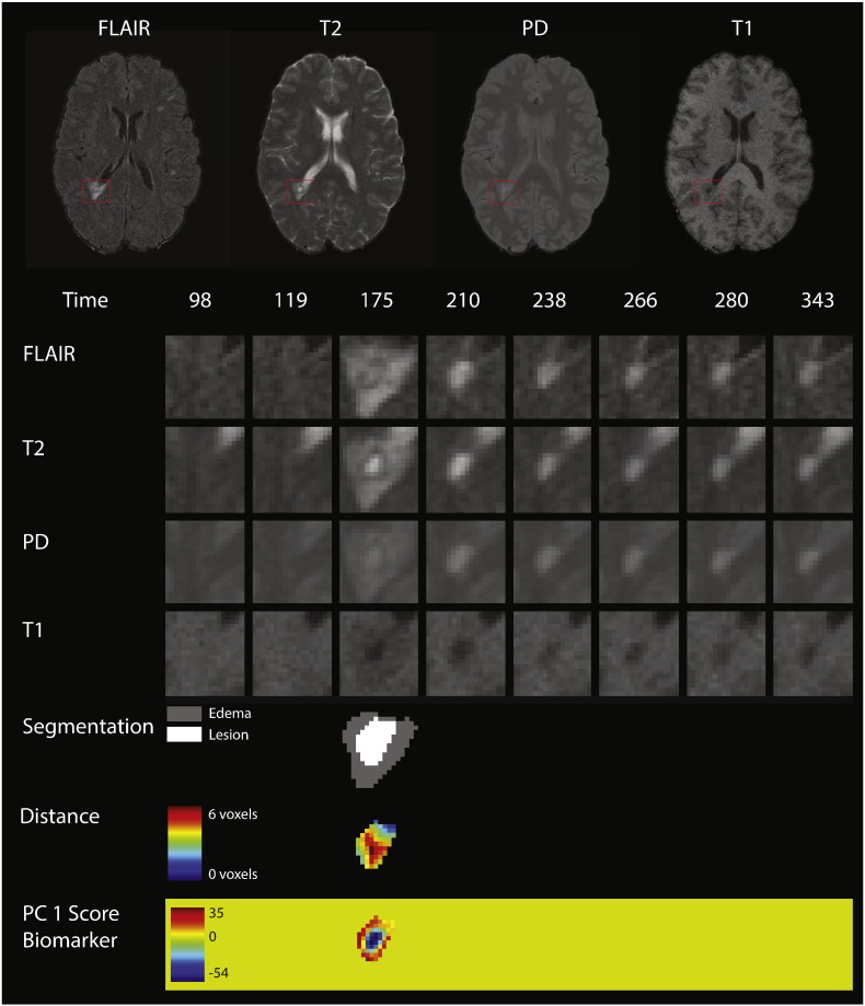 Fig. 2