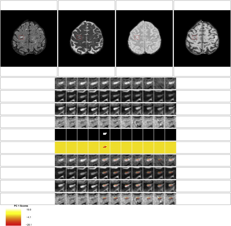 Fig. 12