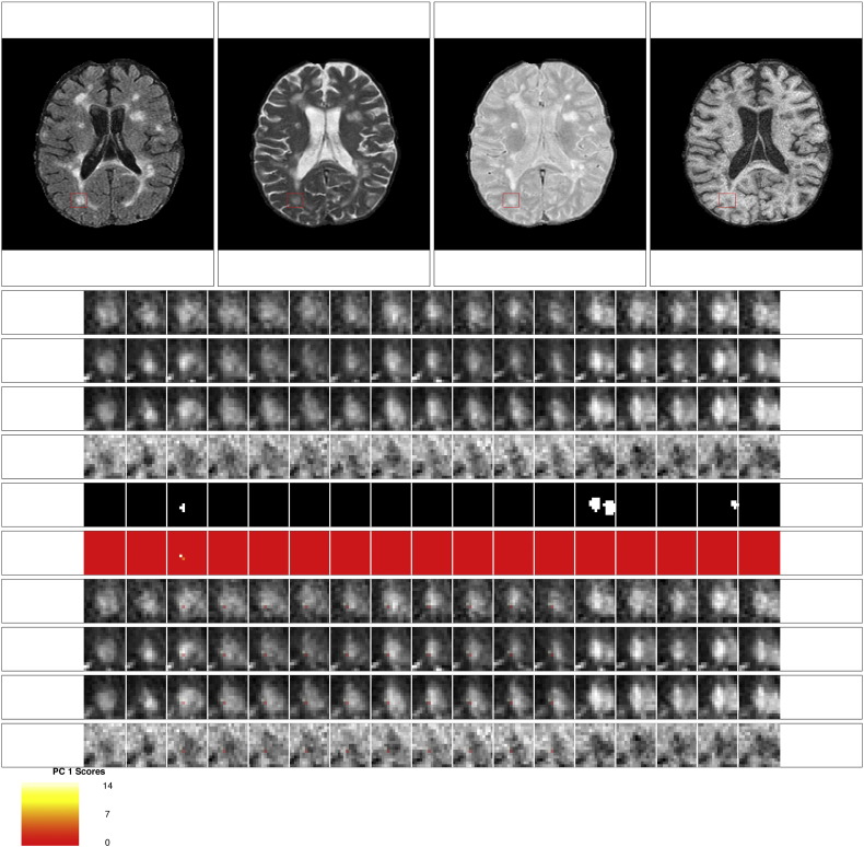 Fig. 11