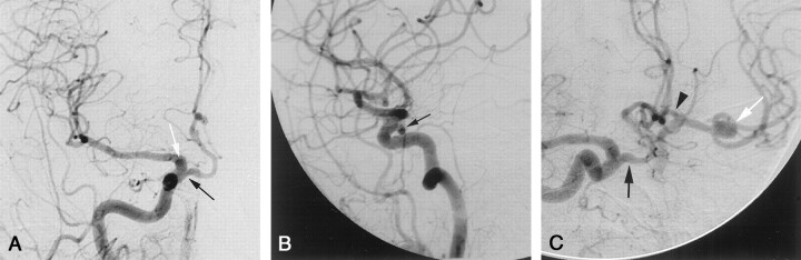 Fig 2.