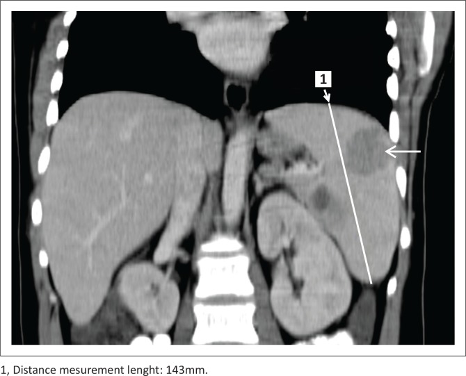 FIGURE 3