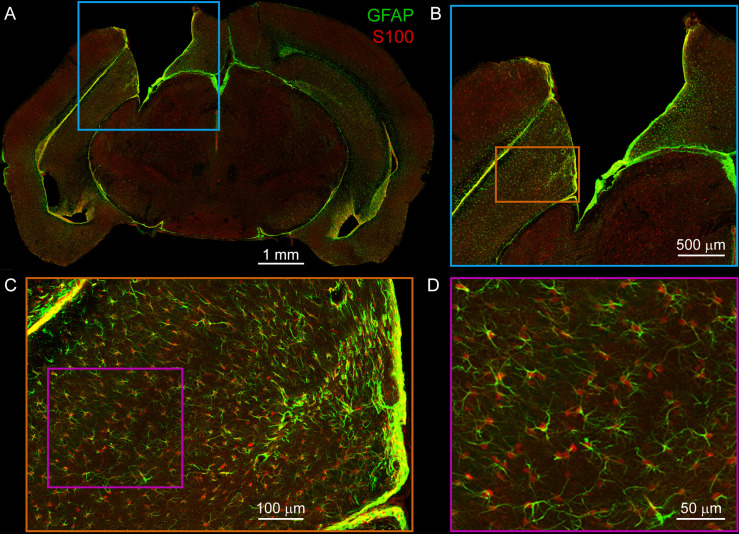 Figure 1—figure supplement 2.