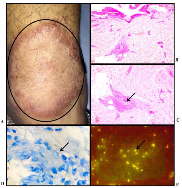 Fig. 4