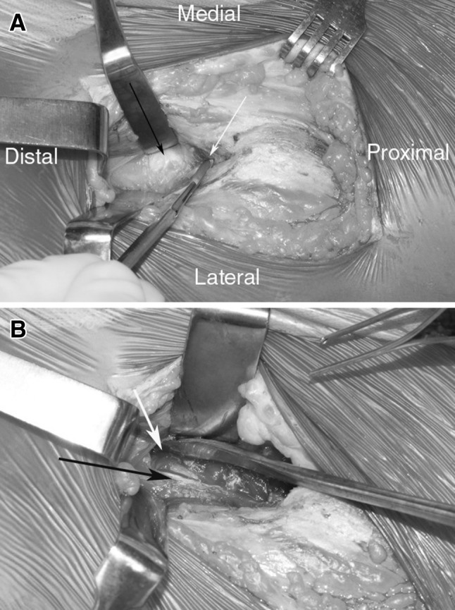 Fig. 2A–B