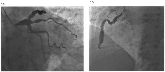 Fig. (1)