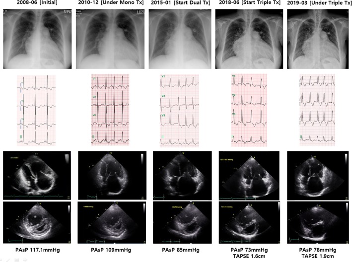 Fig. 2