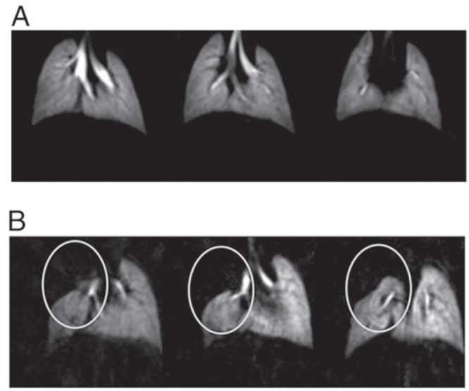 Figure 22.