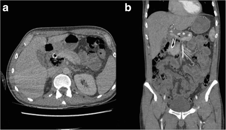 Fig. 2