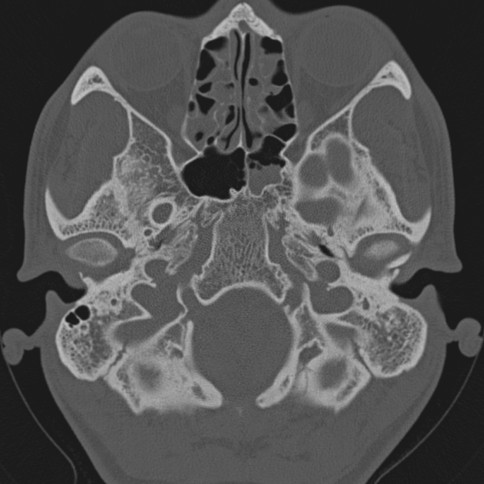 Fig. 3