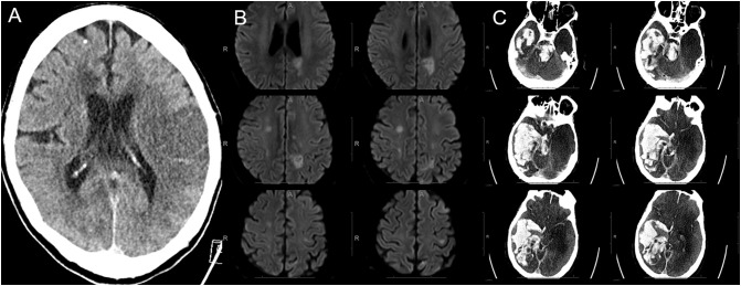 Fig. 1