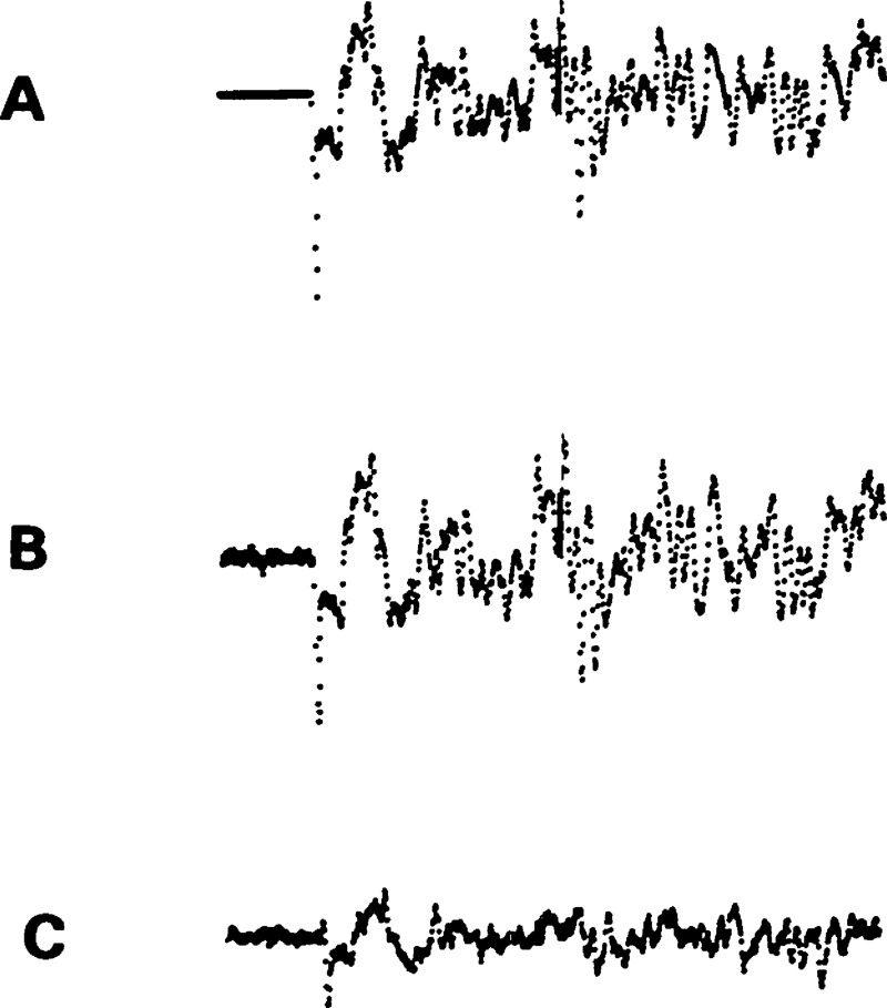 Figure 30