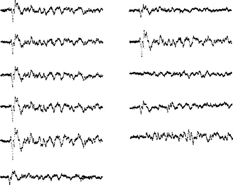 Figure 29