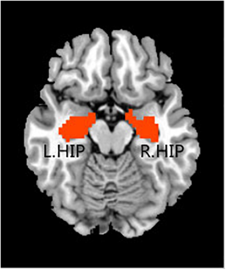 FIGURE 1