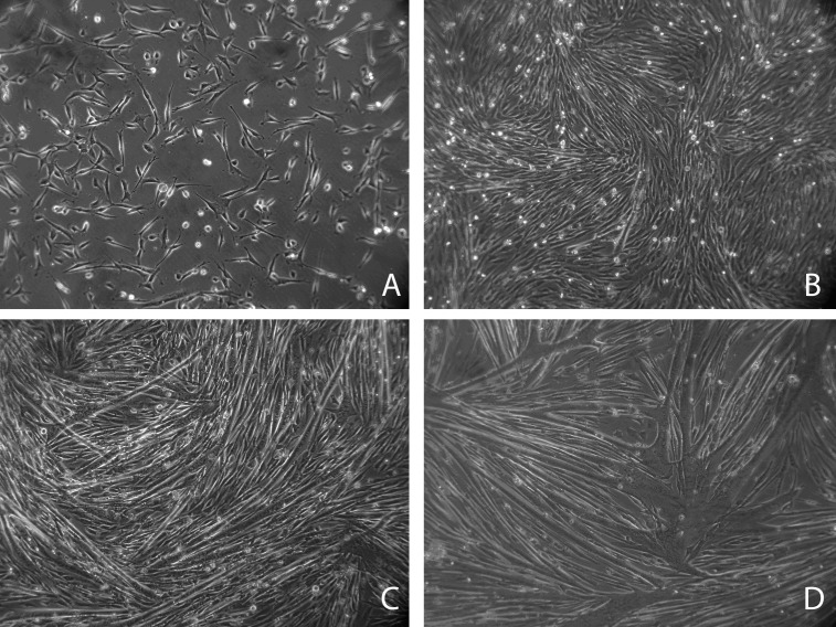 Progression through myogenesis