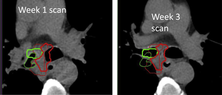 Fig. 4