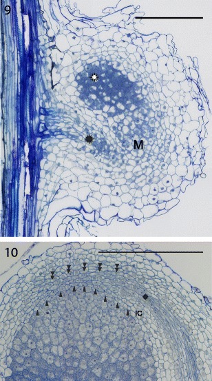 Fig. 9, 10