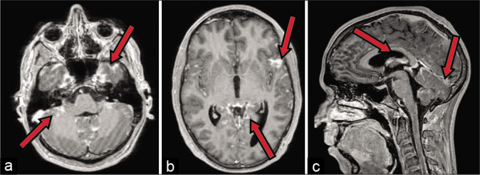 Figure 2: