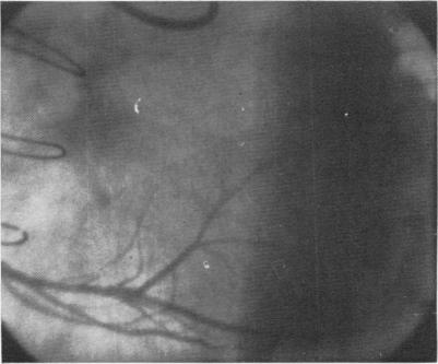 Fig. 7B.