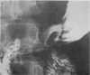 1502-4