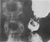 1502-4
